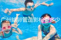 廣州輸卵管造影檢查多少錢，預約時間一次說清楚，想去看