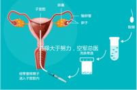 選擇大于努力，空軍總醫院做試管嬰兒必讀攻略