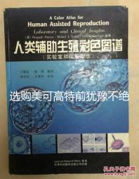 選購美可高特前猶豫不絕，該款羊奶粉品牌質量賣點介紹