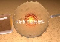 長治和平醫(yī)院骨科