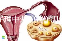 附子理中丸的副作用（附子理中丸的副作用和危害）