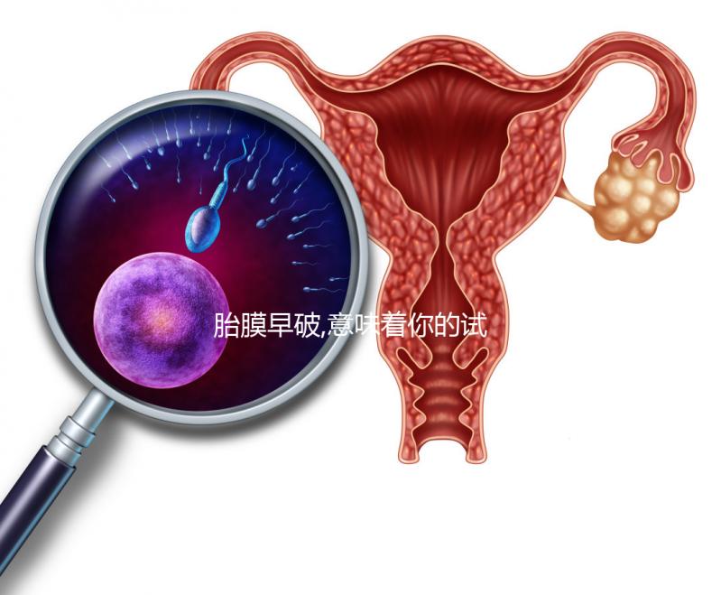 胎膜早破,意味著你的試管嬰兒媽媽夢也破裂了？！