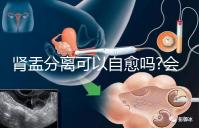 腎盂分離可以自愈嗎?會(huì)不會(huì)自己好要看造成的病因