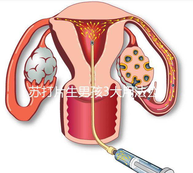 蘇打片生男孩3大用法公布,同房塞陰還是口服分情況