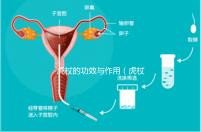 虎杖的功效與作用（虎杖到底是保肝還是傷肝）