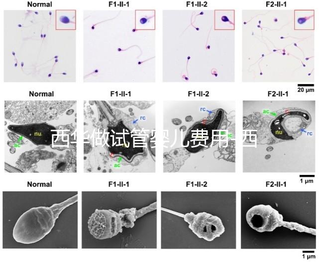 西華做試管嬰兒費用-西華醫(yī)院試管嬰兒花費明細表
