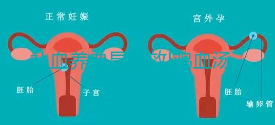 補(bǔ)血養(yǎng)血顯奇效!雞血湯常見(jiàn)的5大功效一覽