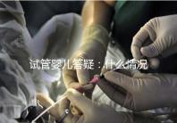 試管嬰兒答疑：什么情況下需要進行PGS和PGD？