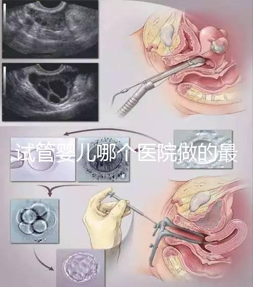 試管嬰兒哪個醫院做的最好呢?多家權威機構推薦
