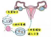 試管嬰兒二超后減藥原因已找到，對胎兒沒影響別瞎擔(dān)心