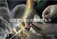 試管嬰兒什么時(shí)候取精（試管嬰兒什么時(shí)候取精是男孩的）