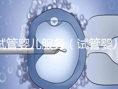 試管嬰兒服務(試管嬰兒服務公司合法嗎)