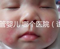 試管嬰兒 哪個醫院（試管嬰兒哪個醫院做的最好）