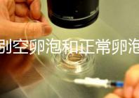 辨別空卵泡和正常卵泡是有技巧的，只需要了解這四個(gè)方面就可以輕松辨別，快速學(xué)習(xí)！