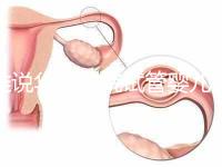 誰(shuí)說(shuō)華西二院試管嬰兒成功率不高，那是你沒(méi)選對(duì)生殖醫(yī)生