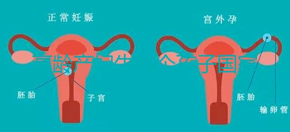 高齡產(chǎn)婦生八個孩子國家有補助？有沒有違法才是關鍵