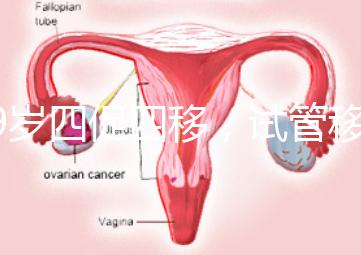 39歲四促四移，試管移植失敗5次后應該怎么辦？
