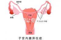 1分鐘解說讓你讀懂，排卵試紙白板一根線等各個(gè)反應(yīng)