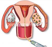 2019清宮圖準不準不知道，但檢測生男女這3種方法才科學