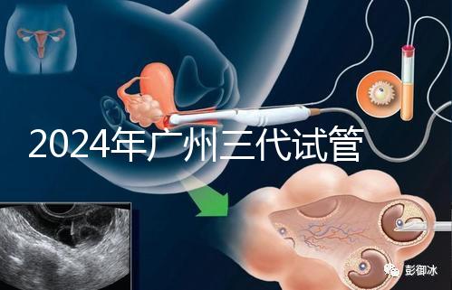 2024年廣州三代試管嬰兒費用明細公布!