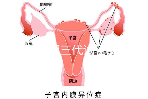 2025昆明三代試管助孕費用一覽，8-15萬元，價格透明公開自主選擇