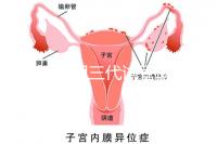 2025昆明三代試管助孕費(fèi)用一覽，8-15萬(wàn)元，價(jià)格透明公開自主選擇